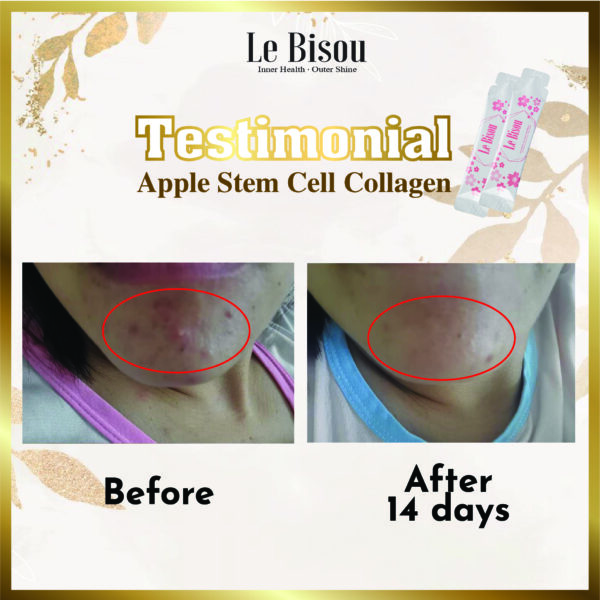 Year-End Beauty Deals - Le Bisou Botanical Beverage Raspberry, Sakura Flower And Collagen【Buy 2 Free 1 Mini Premium Pack】 - Image 7